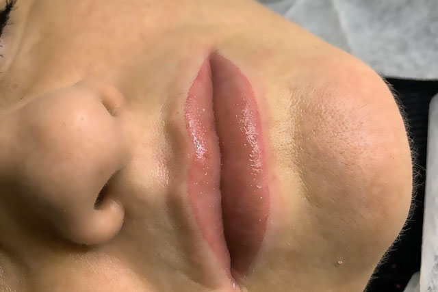 Contour Clinic Braunschweig Gallerie 8