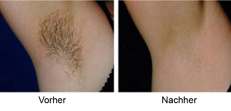 Contour Clinic Braunschweig Gallerie ba1