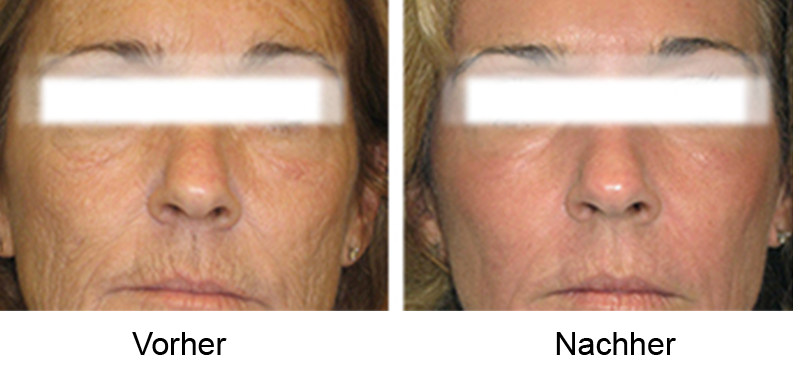 Contour Clinic Braunschweig Gallerie ba5