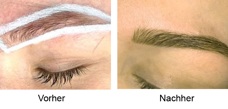 Contour Clinic Braunschweig Gallerie bf4